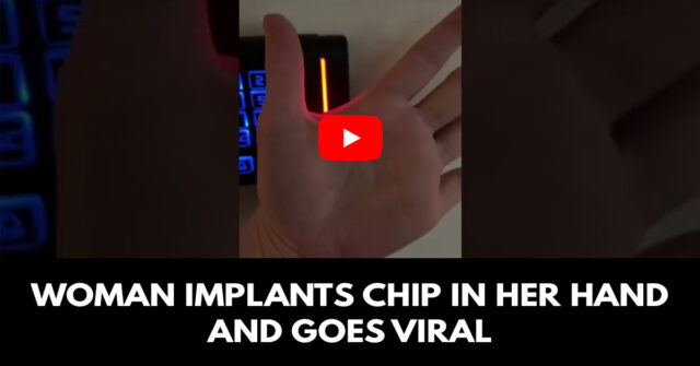 Woman implants chip in her hand and goes viral